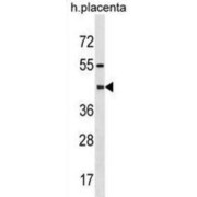 Pregnancy-Specific Beta-1-Glycoprotein 6 (PSG6) Antibody