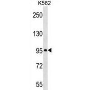 ABI Family Member 3 Binding Protein (ABI3BP) Antibody