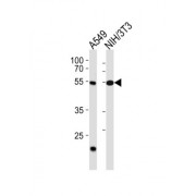 WB analysis of (1) A549, and (2) mouse NIH/3T3 cell line lysates (35 µg/lane), using T-Box Protein 4 (TBX4) Antibody.