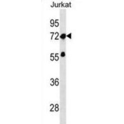 Zinc Finger Protein 286A (ZNF286A) Antibody