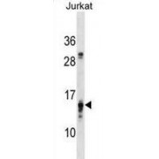 Prefoldin Subunit 4 (PFDN4) Antibody