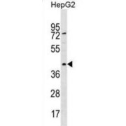 RBMXL1 Antibody