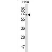 TRAF3 Interacting Protein 2 (TRAF3IP2) Antibody