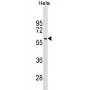 Ribosomal RNA Processing 1 (RRP1) Antibody