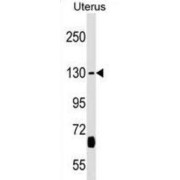 Kinesin-Like Protein KIF27 (KIF27) Antibody