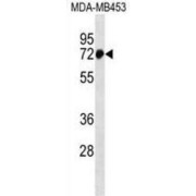 Zinc Finger Protein 326 (ZNF326) Antibody