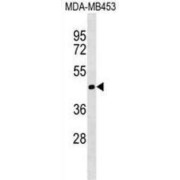 Mitochondrial Import Inner Membrane Translocase Subunit TIM50 (TIMM50) Antibody