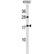 Gastrokine 1 (GKN1) Antibody