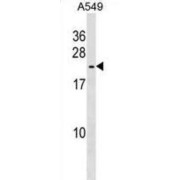 Heat Shock Protein Beta-9 (HSPB9) Antibody