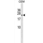 TAK1 Like Protein (TAK1L) Antibody