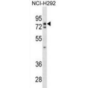 ATPase WRNIP1 (WRNIP1) Antibody