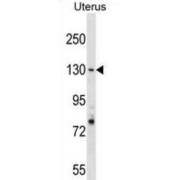 Replication Factor C Subunit 1 (RFC1) Antibody