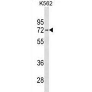 Interleukin 22 Receptor Subunit Alpha 1 (IL22RA1) Antibody