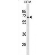 Acid-Sensing Ion Channel 3 (ACCN3) Antibody