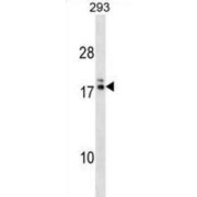 Hippocampus Abundant Transcript-Like Protein 2 (HIATL2) Antibody
