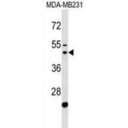 Cytosolic Arginine Sensor For MTORC1 Subunit 2 (GATSL1) Antibody
