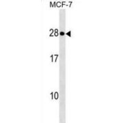 ER Lumen Protein-Retaining Receptor 1 (KDELR1) Antibody
