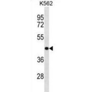 Zinc Finger Protein 73 (ZNF73) Antibody