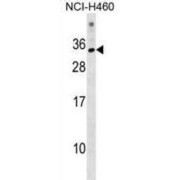 KRAB Domain-Containing Protein 1 (KRBOX1) Antibody