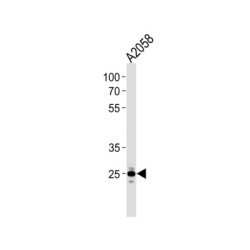 Mitochondrial Ribosomal Protein L28 (MRPL28) Antibody
