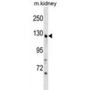 WD Repeat-Containing Protein 64 (WDR64) Antibody