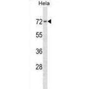 Protein Kinase C Substrate 80K-H (PRKCSH) Antibody