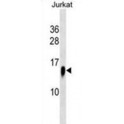 WB analyis of Jurkat cell line lysates.