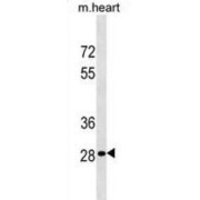 Homeobox Protein Hox-B13 (HOXB13) Antibody