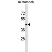 5-Hydroxytryptamine Receptor 1D (HTR1D) Antibody