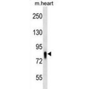 Ubiquitin-Associated And SH3 Domain-Containing Protein A (UBASH3A) Antibody