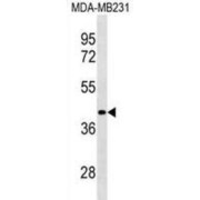 Leucine-Rich Repeat-Containing Protein 39 (LRRC39) Antibody