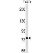 Bestrophin-3 (BEST3) Antibody