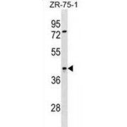 SIRPB2 Antibody
