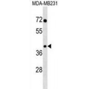 snRNA-Activating Protein Complex Subunit 3 (SNAPC3) Antibody