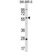 TATA-Box Binding Protein Associated Factor 6 Like (TAF6L) Antibody