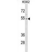 Zinc Finger Protein 736 (ZNF736) Antibody