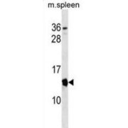 Tumor Suppressor ARF (CDKN2A) Antibody