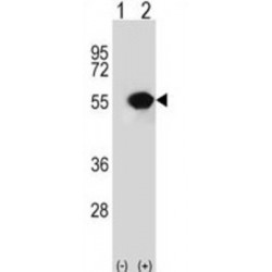 RuvB-Like 1/Pontin 52 (RUVBL1) Antibody