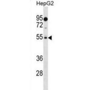 PRAME Family Member 18 (PRAMEF18) Antibody