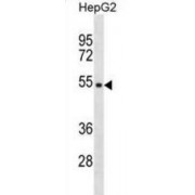 Transmembrane Protein With Metallophosphoesterase Domain (TMPPE) Antibody
