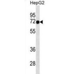 Forkhead Box Protein N3 (FOXN3) Antibody