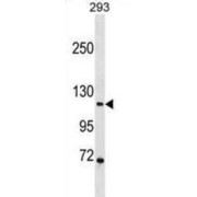 abx030889