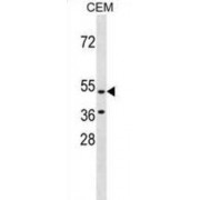 G Protein Coupled Receptor 109B (GPR109B) Antibody