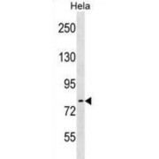 Rho Guanine Nucleotide Exchange Factor 33 (ARHGEF33) Antibody