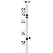 Olfactory Receptor Family 6 Subfamily B Member 2 (OR6B2) Antibody
