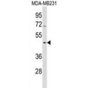 Septin 12 (SEPTIN12) Antibody