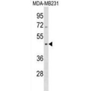 Septin 12 (SEPTIN12) Antibody