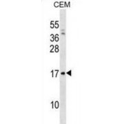 Pre-B-Lymphocyte Gene 1 (VPREB1) Antibody