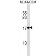 Western blot analysis of MDA-MB231 cell lysates (35 µg per lane) using Placenta-Specific Protein 1 Antibody.