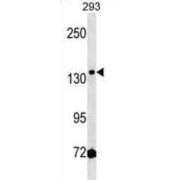 HMG-Box Containing 3 (HMGXB3) Antibody